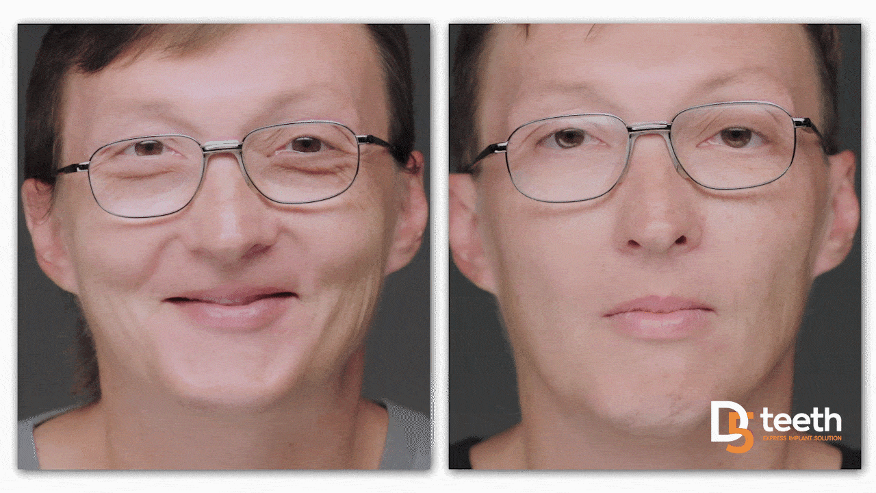 Cliff new smile transformation