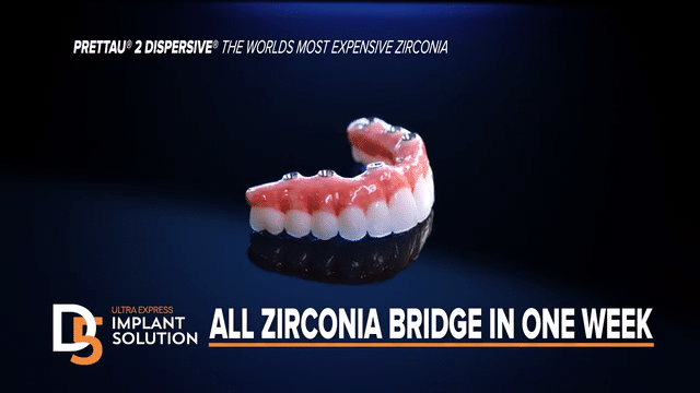 D5teeth Hybrid Bridge